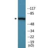 Western Blot - Anti-AKT1 + AKT3 (phospho Tyr437 + Tyr434) Antibody (P12-1074) - Antibodies.com