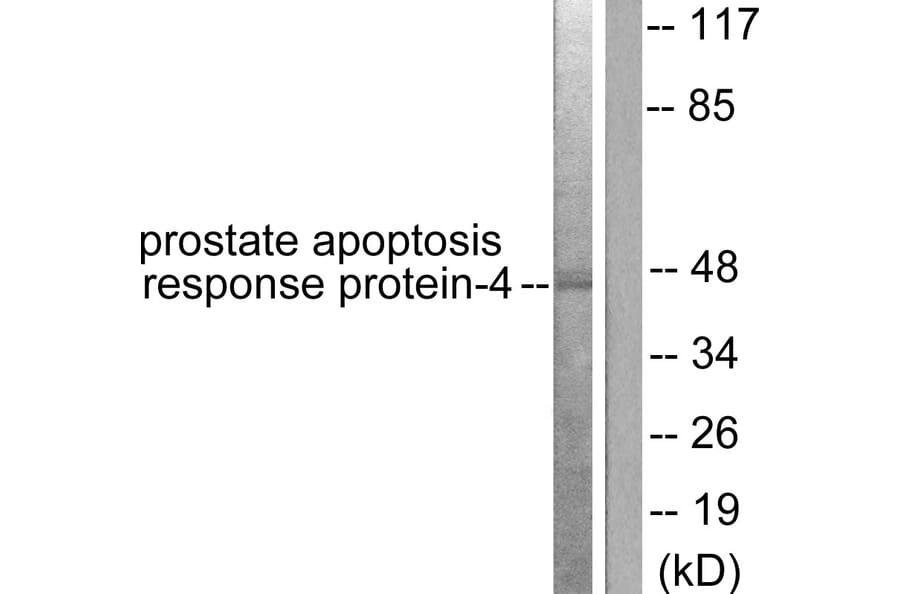 Western Blot - Anti-Prostate Apoptosis Response protein-4 Antibody (C0309) - Antibodies.com