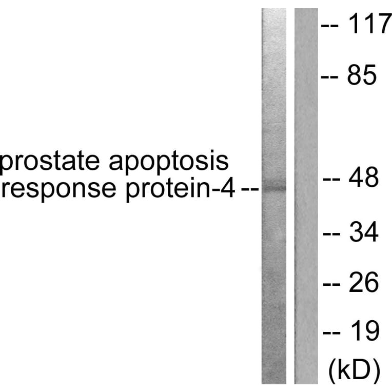 Western Blot - Anti-Prostate Apoptosis Response protein-4 Antibody (C0309) - Antibodies.com