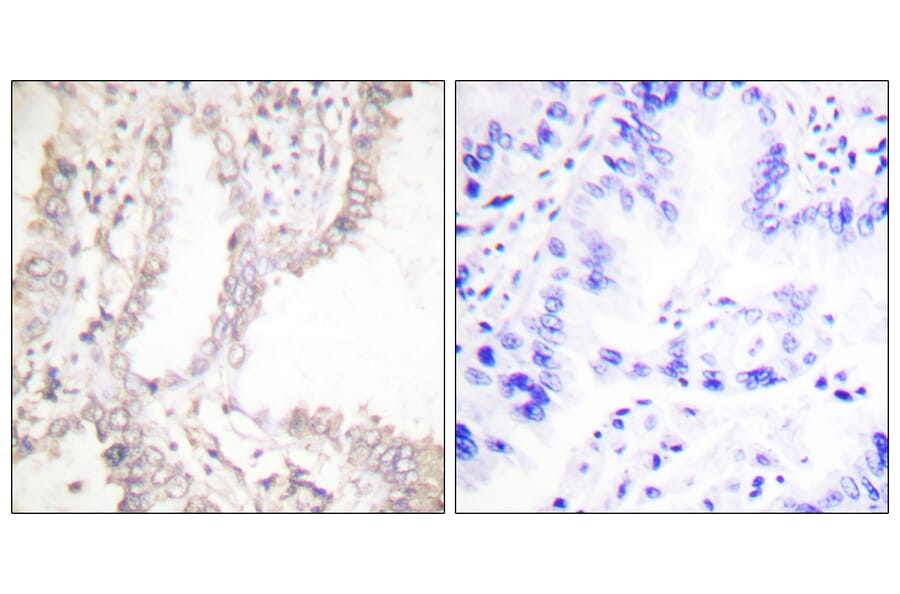 Immunohistochemistry - Anti-Prostate Apoptosis Response protein-4 Antibody (C0309) - Antibodies.com