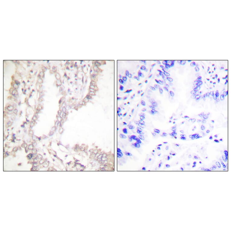 Immunohistochemistry - Anti-Prostate Apoptosis Response protein-4 Antibody (C0309) - Antibodies.com