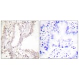 Immunohistochemistry - Anti-Prostate Apoptosis Response protein-4 Antibody (C0309) - Antibodies.com