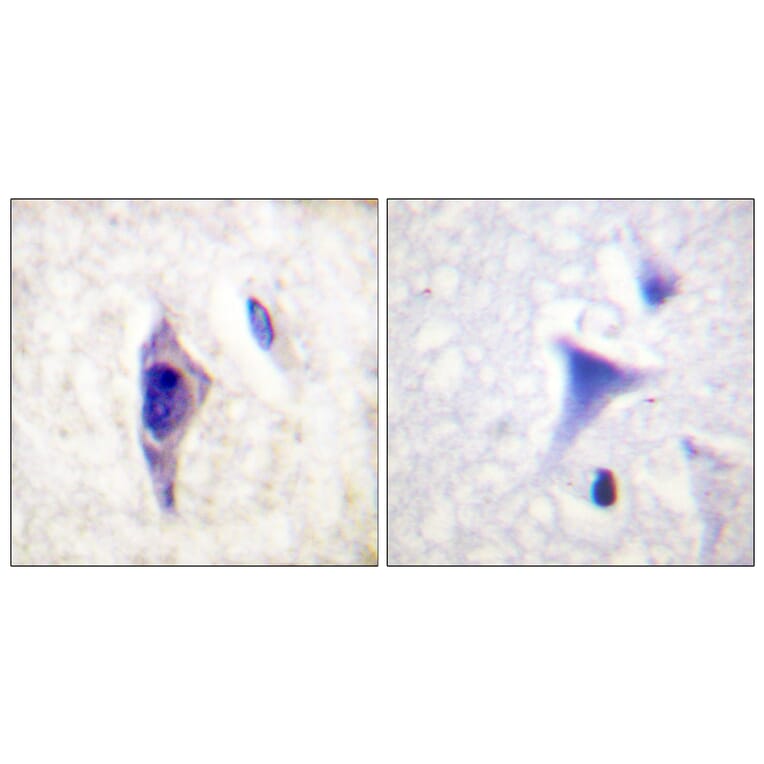 Immunohistochemistry - Anti-PI3-kinase p85-alpha (phospho Tyr607) Antibody (A1225) - Antibodies.com