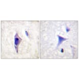 Immunohistochemistry - Anti-PI3-kinase p85-alpha (phospho Tyr607) Antibody (A1225) - Antibodies.com