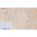 Immunohistochemistry - Anti-PI3-kinase p85-alpha (phospho Tyr607) Antibody (A1225) - Antibodies.com