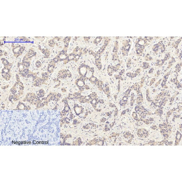 Immunohistochemistry - Anti-PI3-kinase p85-alpha (phospho Tyr607) Antibody (A1225) - Antibodies.com
