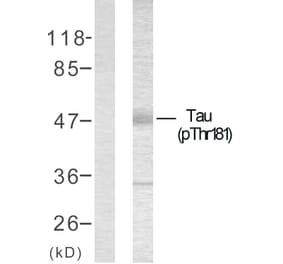Western Blot - Anti-Tau (phospho Thr181) Antibody (A7244) - Antibodies.com
