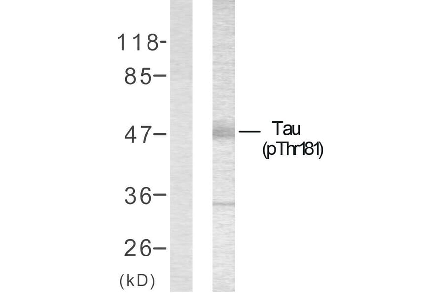 Western Blot - Anti-Tau (phospho Thr181) Antibody (A7244) - Antibodies.com