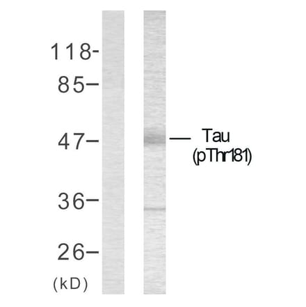 Western Blot - Anti-Tau (phospho Thr181) Antibody (A7244) - Antibodies.com