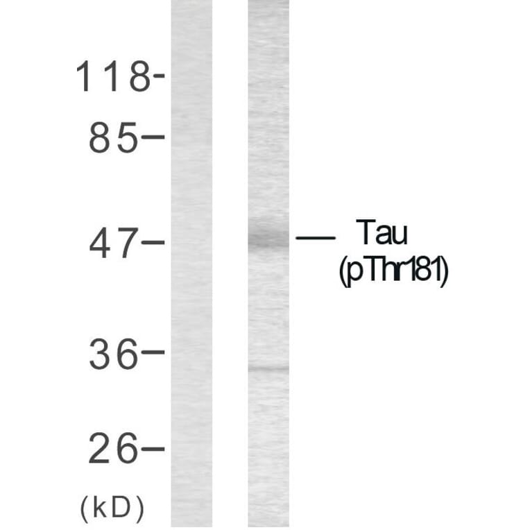 Western Blot - Anti-Tau (phospho Thr181) Antibody (A7244) - Antibodies.com