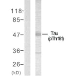 Western Blot - Anti-Tau (phospho Thr181) Antibody (A7244) - Antibodies.com