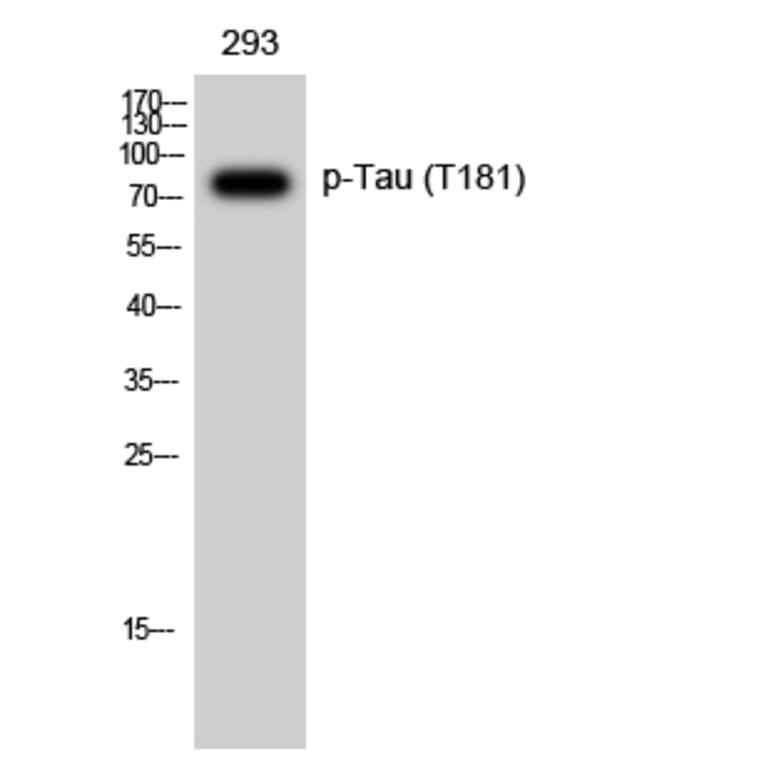 Western Blot - Anti-Tau (phospho Thr181) Antibody (A7244) - Antibodies.com