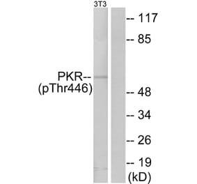 Western Blot - Anti-PKR (phospho Thr446) Antibody (A7198) - Antibodies.com