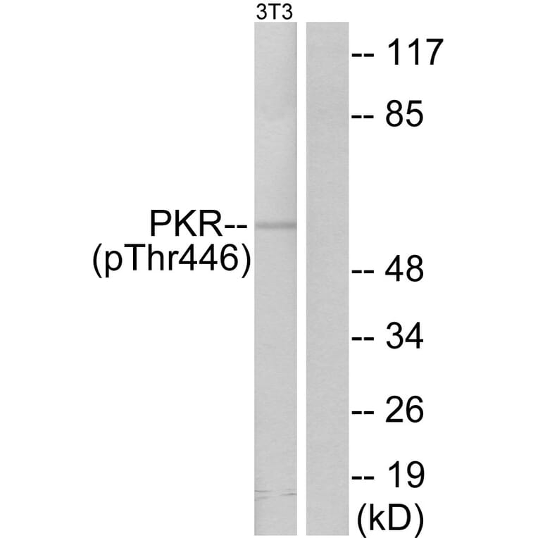 Western Blot - Anti-PKR (phospho Thr446) Antibody (A7198) - Antibodies.com