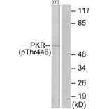 Western Blot - Anti-PKR (phospho Thr446) Antibody (A7198) - Antibodies.com