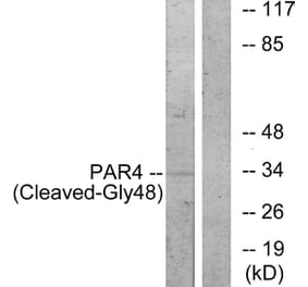 Western Blot - Anti-PAR4 (cleaved Gly48) Antibody (L0377) - Antibodies.com