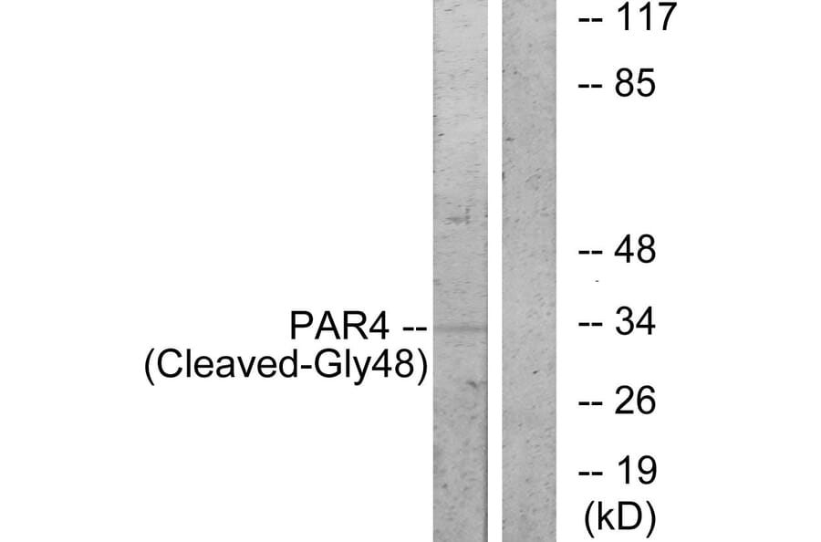 Western Blot - Anti-PAR4 (cleaved Gly48) Antibody (L0377) - Antibodies.com