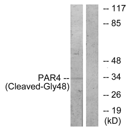 Western Blot - Anti-PAR4 (cleaved Gly48) Antibody (L0377) - Antibodies.com