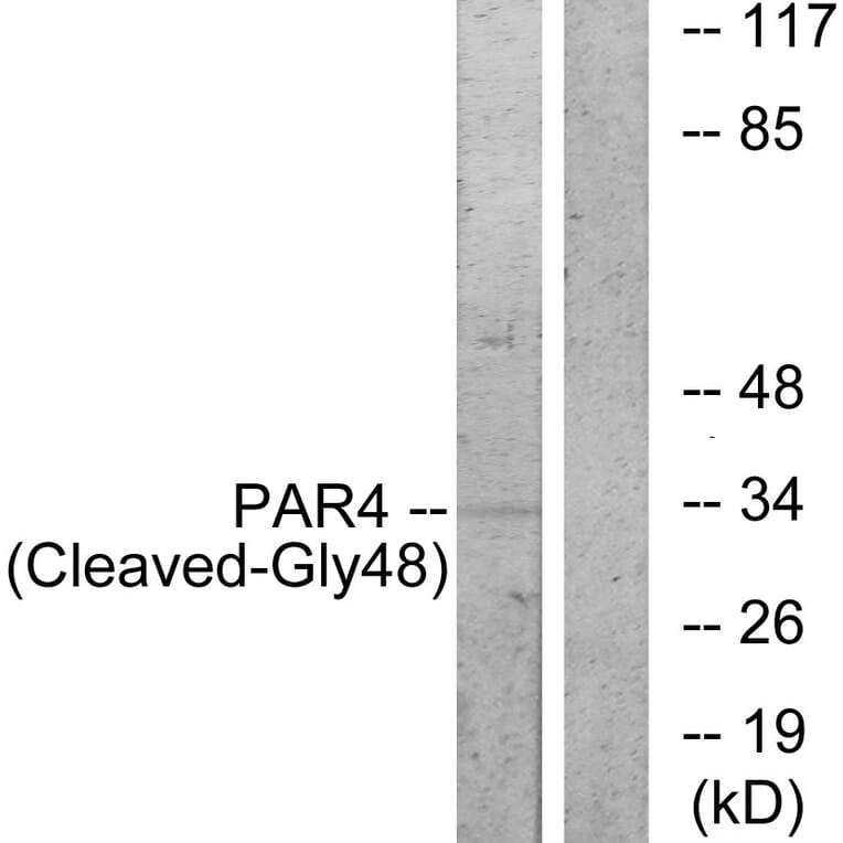 Western Blot - Anti-PAR4 (cleaved Gly48) Antibody (L0377) - Antibodies.com
