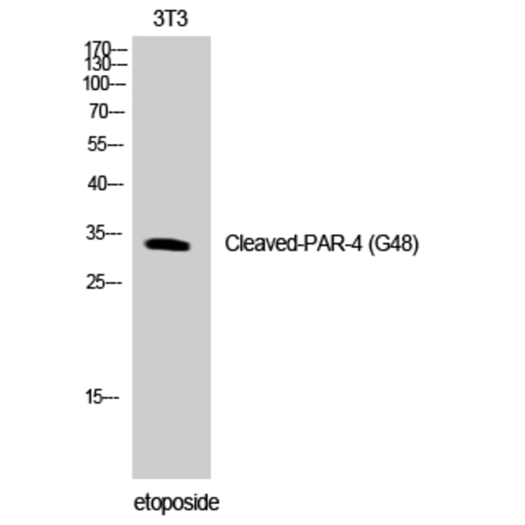 Western Blot - Anti-PAR4 (cleaved Gly48) Antibody (L0377) - Antibodies.com