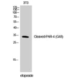Western Blot - Anti-PAR4 (cleaved Gly48) Antibody (L0377) - Antibodies.com