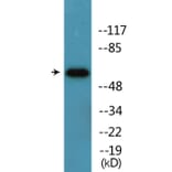Western Blot - Anti-HS1 (phospho Tyr397) Antibody (P12-1117) - Antibodies.com