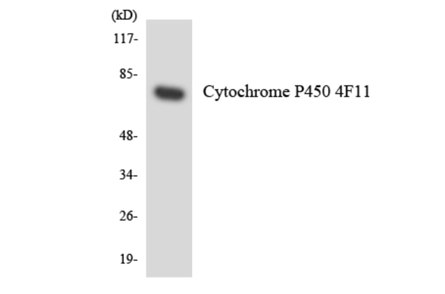Western Blot - Anti-Cytochrome P450 4F11 Antibody (R12-2683) - Antibodies.com