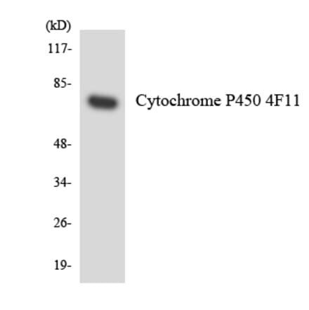 Western Blot - Anti-Cytochrome P450 4F11 Antibody (R12-2683) - Antibodies.com