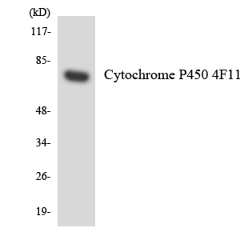 Western Blot - Anti-Cytochrome P450 4F11 Antibody (R12-2683) - Antibodies.com