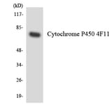 Western Blot - Anti-Cytochrome P450 4F11 Antibody (R12-2683) - Antibodies.com