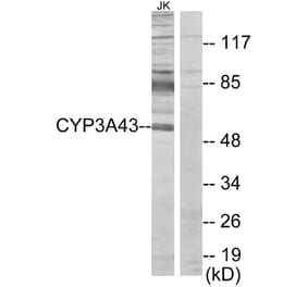 Western Blot - Anti-Cytochrome P450 3A43 Antibody (C12274) - Antibodies.com