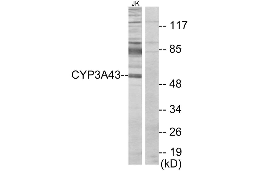 Western Blot - Anti-Cytochrome P450 3A43 Antibody (C12274) - Antibodies.com