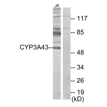 Western Blot - Anti-Cytochrome P450 3A43 Antibody (C12274) - Antibodies.com