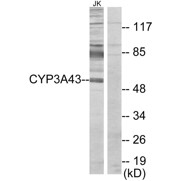 Western Blot - Anti-Cytochrome P450 3A43 Antibody (C12274) - Antibodies.com