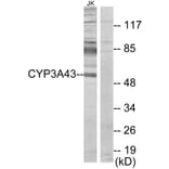 Western Blot - Anti-Cytochrome P450 3A43 Antibody (C12274) - Antibodies.com