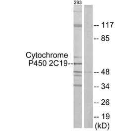 Western Blot - Anti-Cytochrome P450 2C19 Antibody (C12265) - Antibodies.com