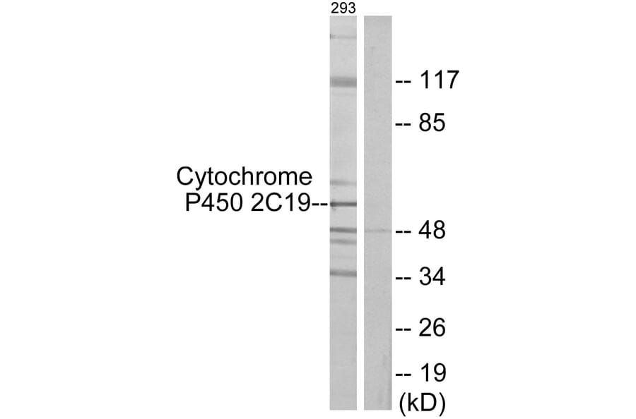 Western Blot - Anti-Cytochrome P450 2C19 Antibody (C12265) - Antibodies.com