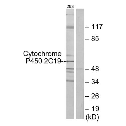 Western Blot - Anti-Cytochrome P450 2C19 Antibody (C12265) - Antibodies.com