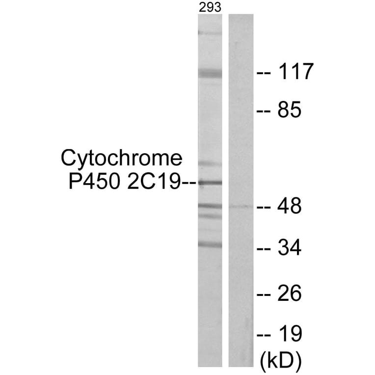 Western Blot - Anti-Cytochrome P450 2C19 Antibody (C12265) - Antibodies.com