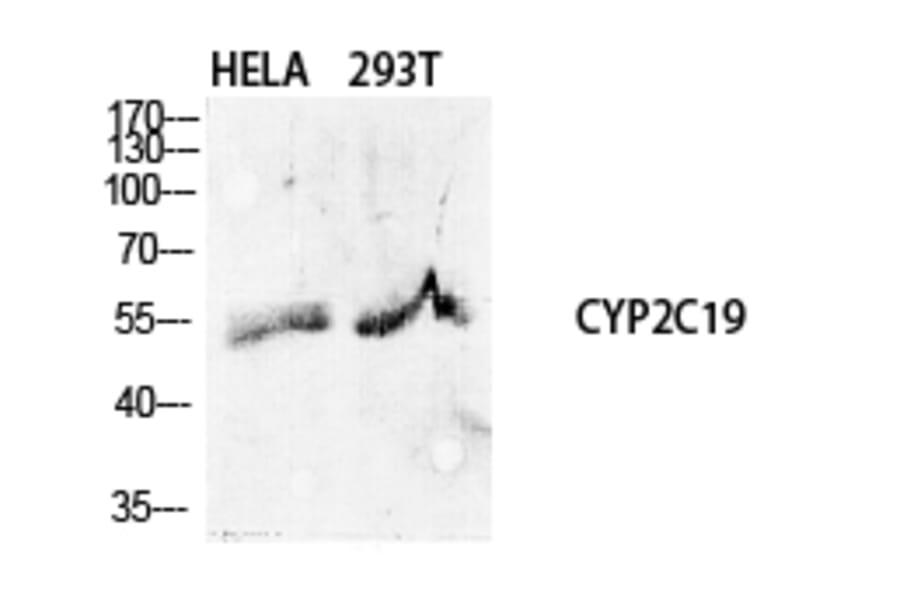 Western Blot - Anti-Cytochrome P450 2C19 Antibody (C12265) - Antibodies.com