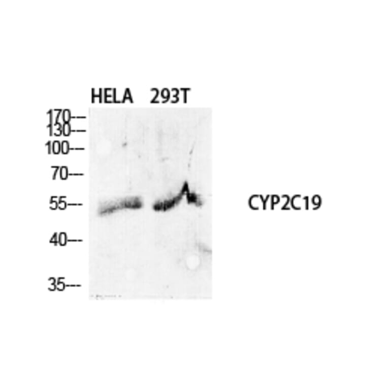 Western Blot - Anti-Cytochrome P450 2C19 Antibody (C12265) - Antibodies.com