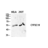 Western Blot - Anti-Cytochrome P450 2C19 Antibody (C12265) - Antibodies.com