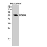 Western Blot - Anti-Cytochrome P450 2C19 Antibody (C12265) - Antibodies.com