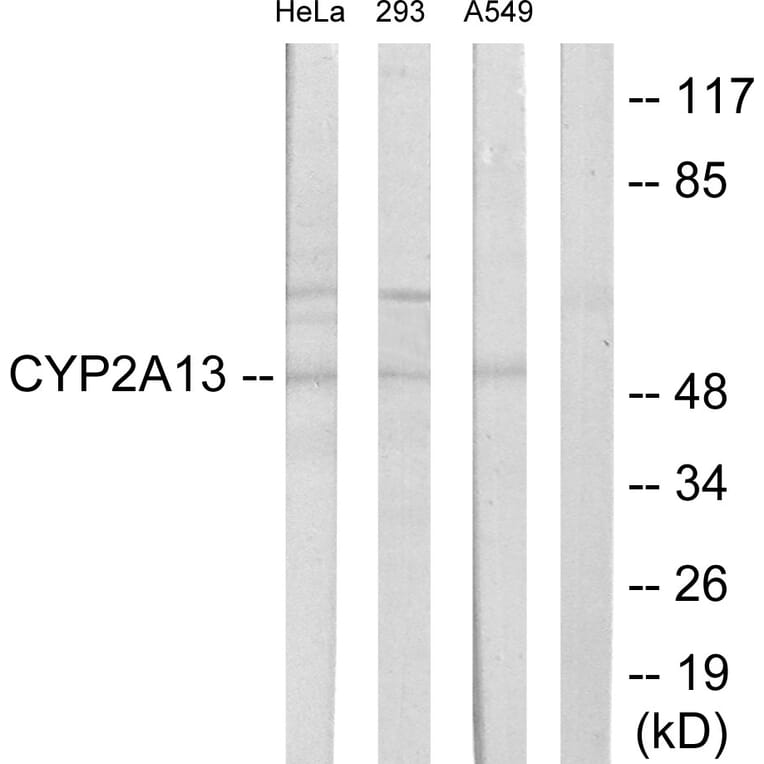 Western Blot - Anti-Cytochrome P450 2A13 Antibody (C12260) - Antibodies.com