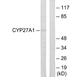 Western Blot - Anti-Cytochrome P450 27A1 Antibody (C12257) - Antibodies.com