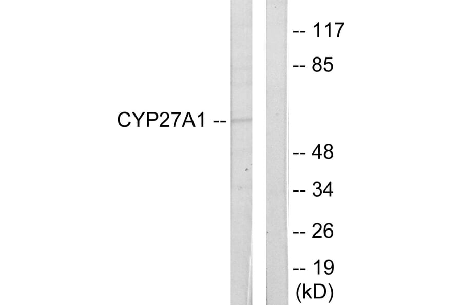 Western Blot - Anti-Cytochrome P450 27A1 Antibody (C12257) - Antibodies.com