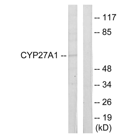 Western Blot - Anti-Cytochrome P450 27A1 Antibody (C12257) - Antibodies.com