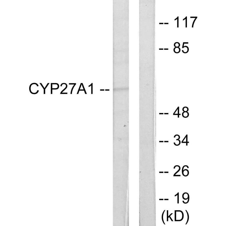 Western Blot - Anti-Cytochrome P450 27A1 Antibody (C12257) - Antibodies.com