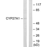 Western Blot - Anti-Cytochrome P450 27A1 Antibody (C12257) - Antibodies.com