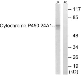 Western Blot - Anti-Cytochrome P450 24A1 Antibody (C12253) - Antibodies.com